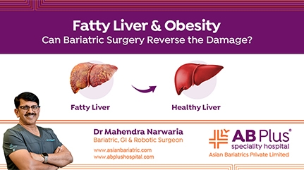 Fatty Liver & Obesity: Can Bariatric Surgery Reverse the Damage?
