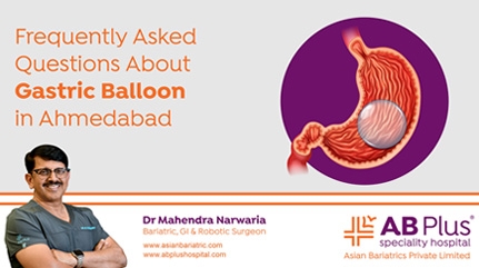 Frequently Asked Questions About Gastric Balloon in Ahmedabad