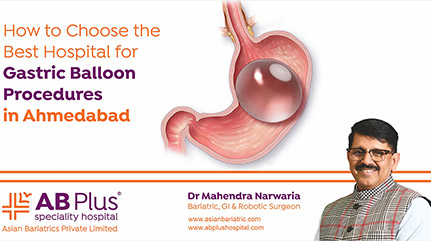 How to Choose the Best Hospital for Gastric Balloon Procedures in Ahmedabad