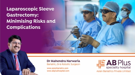 Laparoscopic Sleeve Gastrectomy: Minimising Risks and Complications
