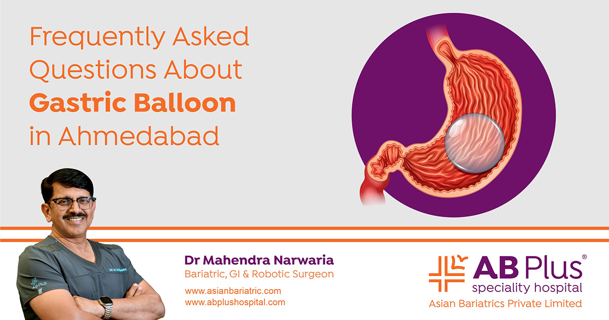 Frequently Asked Questions About Gastric Balloon