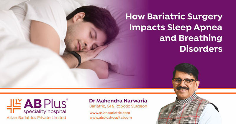 How Bariatric Surgery Impacts Sleep Apnea and Breathing Disorders