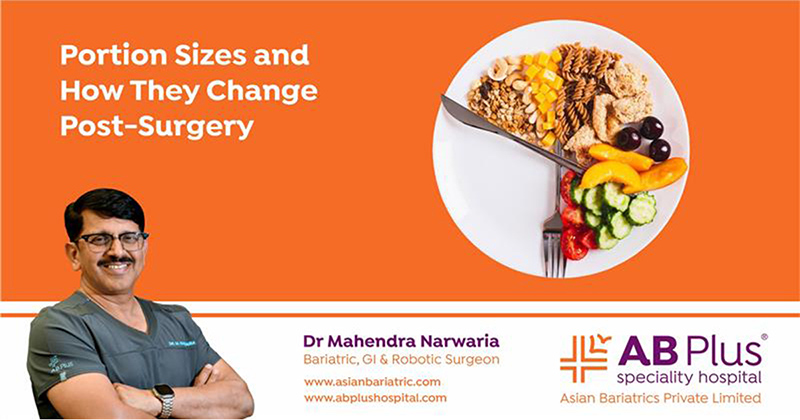 Portion Sizes and How They Change Post-Surgery